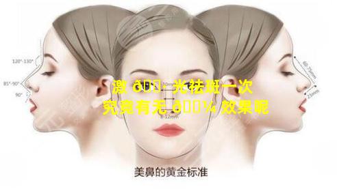 激 🌷 光祛斑一次究竟有无 🌼 效果呢
